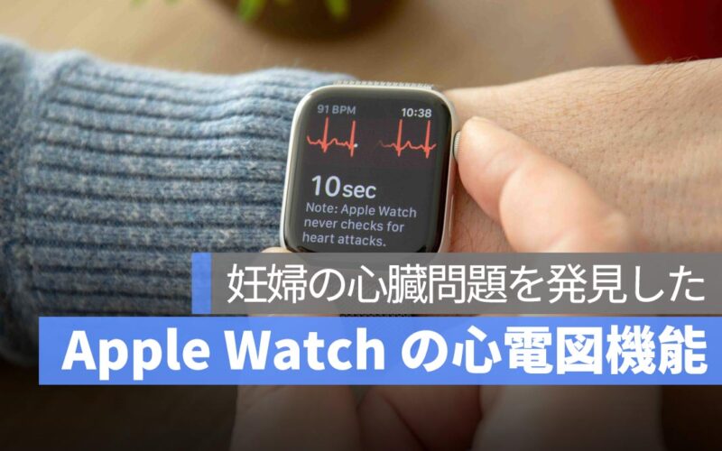 Apple Watch の心電図機能が妊婦の心臓問題を発見し、母子の命を救う